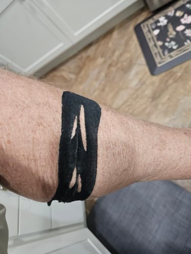 Verified buyer photo — black pre-cut kinesiology tape worn on a bare forearm, skin clear under and around the strip