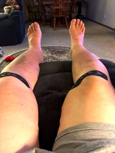 Verified buyer photo — black pre-cut kinesiology tape strips worn on both knees at home, legs resting on an ottoman